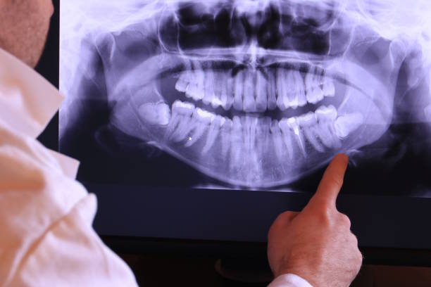 Best Broken Tooth Emergency  in Arcadia, LA